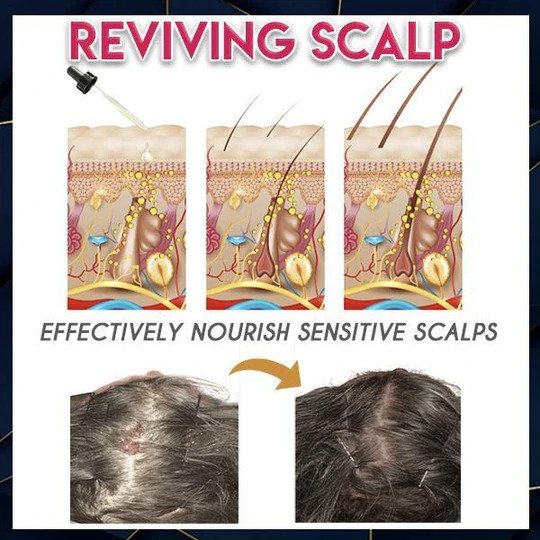 Esencia pura para el crecimiento del cabello - Image 2