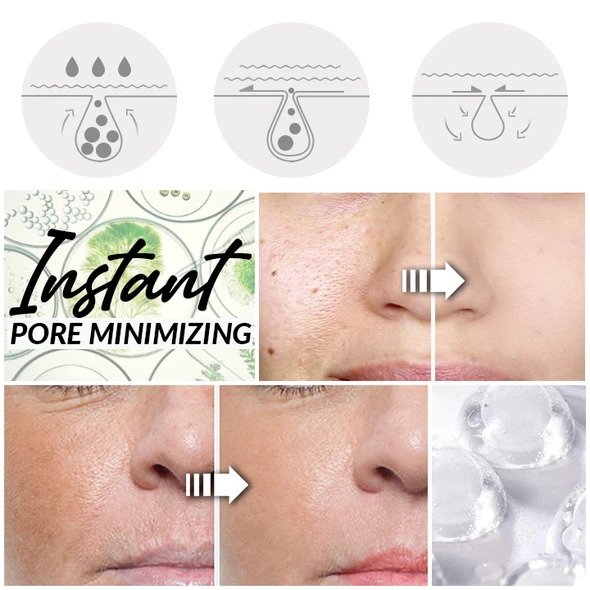 Esencia perfeccionadora y refinadora de poros - Image 3