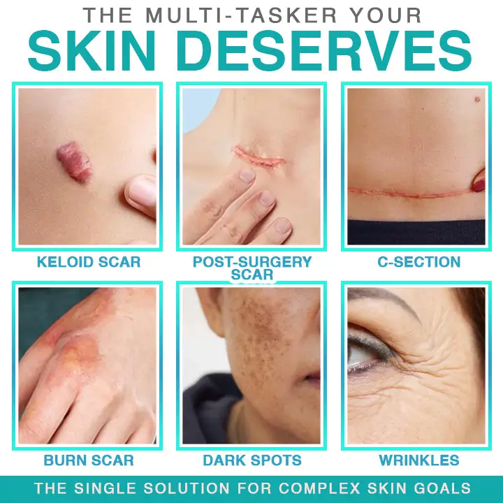 𝗖𝗮𝗿𝗲𝗕𝗿𝗲𝗲𝘇𝗲® Parche para el cuidado de microagujas 3 en 1 - Image 2