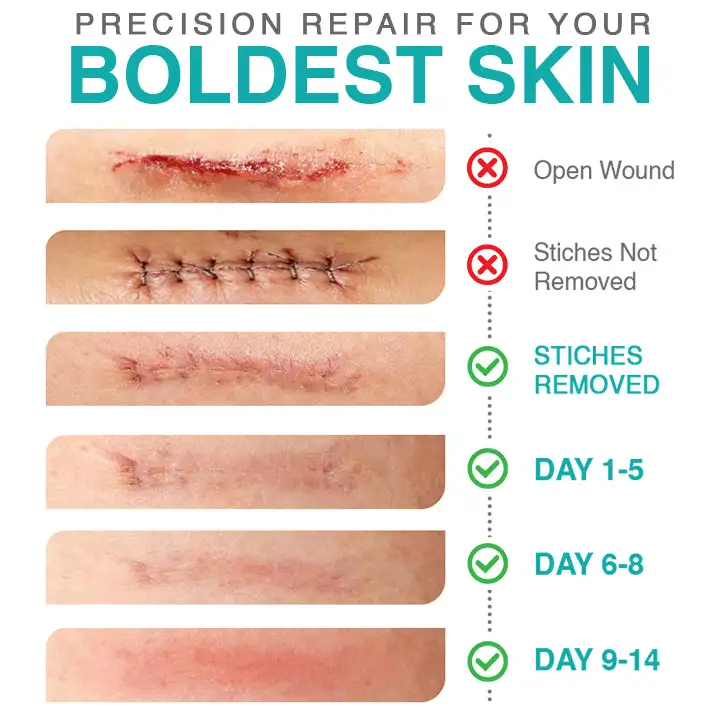 𝗖𝗮𝗿𝗲𝗕𝗿𝗲𝗲𝘇𝗲® Parche para el cuidado de microagujas 3 en 1 - Image 4