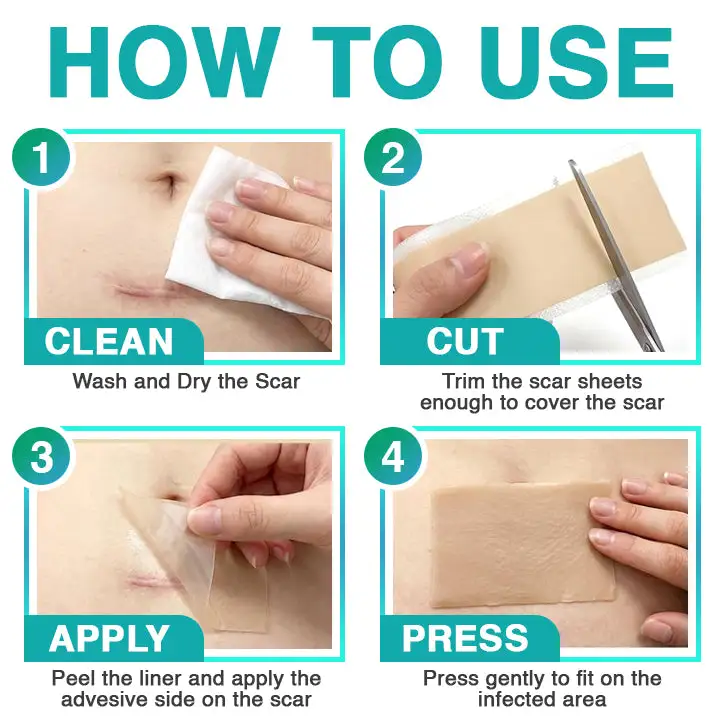 𝗖𝗮𝗿𝗲𝗕𝗿𝗲𝗲𝘇𝗲® Parche para el cuidado de microagujas 3 en 1 - Image 7