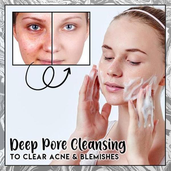 Barra de jabón para eliminar la celulitis con ceniza volcánica de café - Image 5