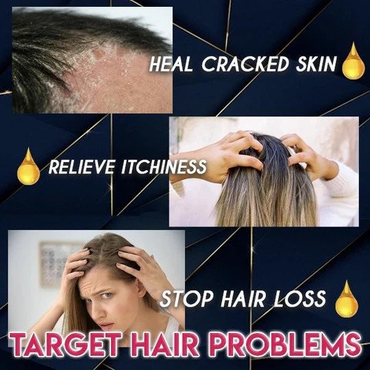 Esencia pura para el crecimiento del cabello - Image 6