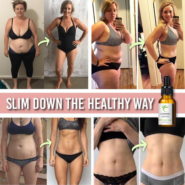 Cinturón de abdominoplastia con suero para quemar grasa - Image 6