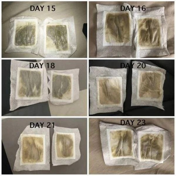 Parche desintoxicante linfático para el cuello Nutrispot (juego de 10) - Image 5