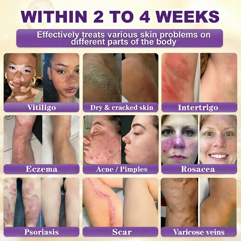 Acezozla® Biotina Crema Restauradora de la Piel 10 en 1 - Image 2