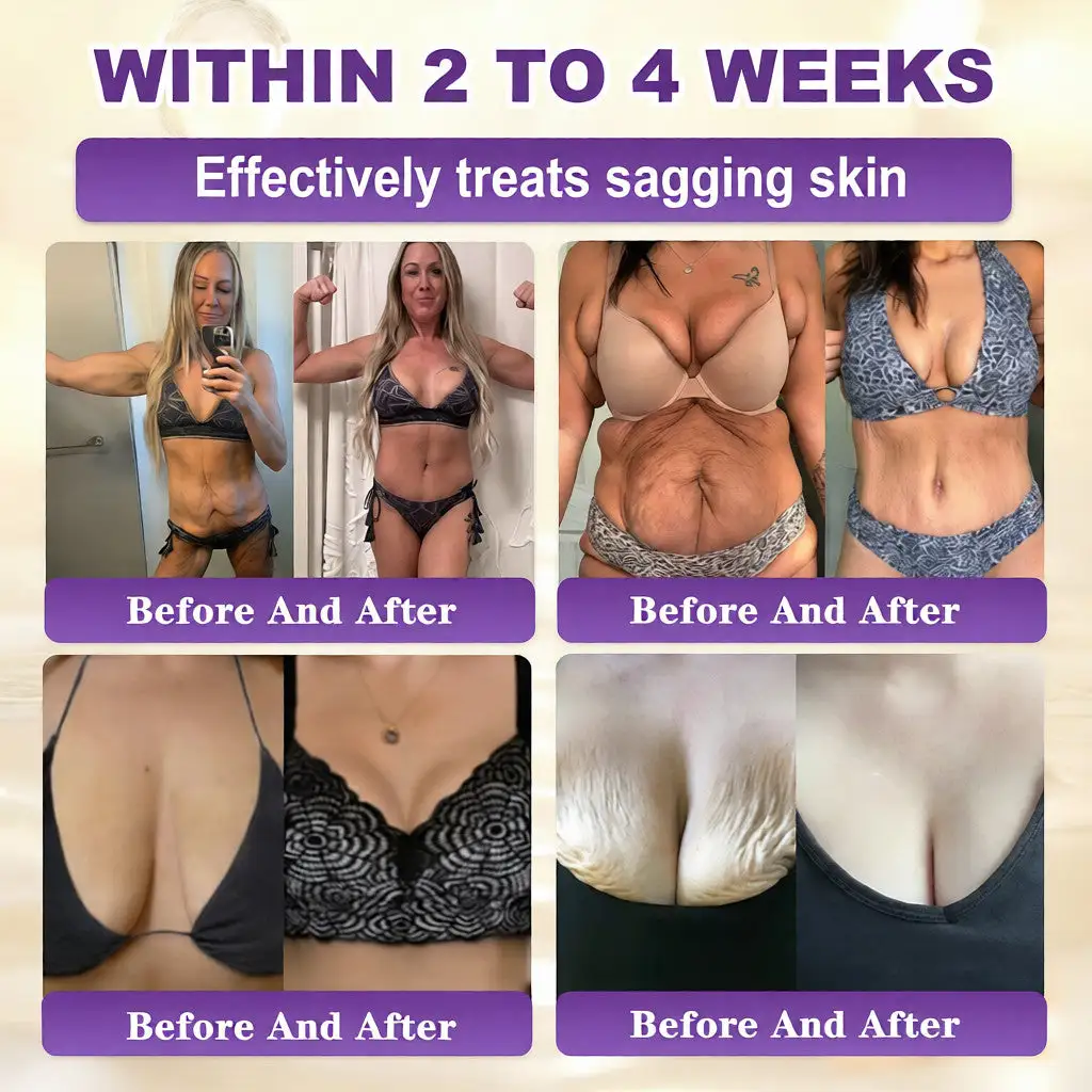 Acezozla® Biotina Crema Restauradora de la Piel 10 en 1 - Image 3