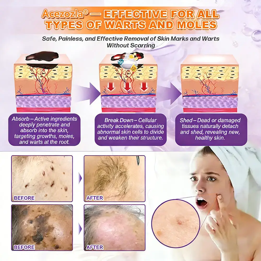 Acezozla® Biotina Crema Restauradora de la Piel 10 en 1 - Image 9