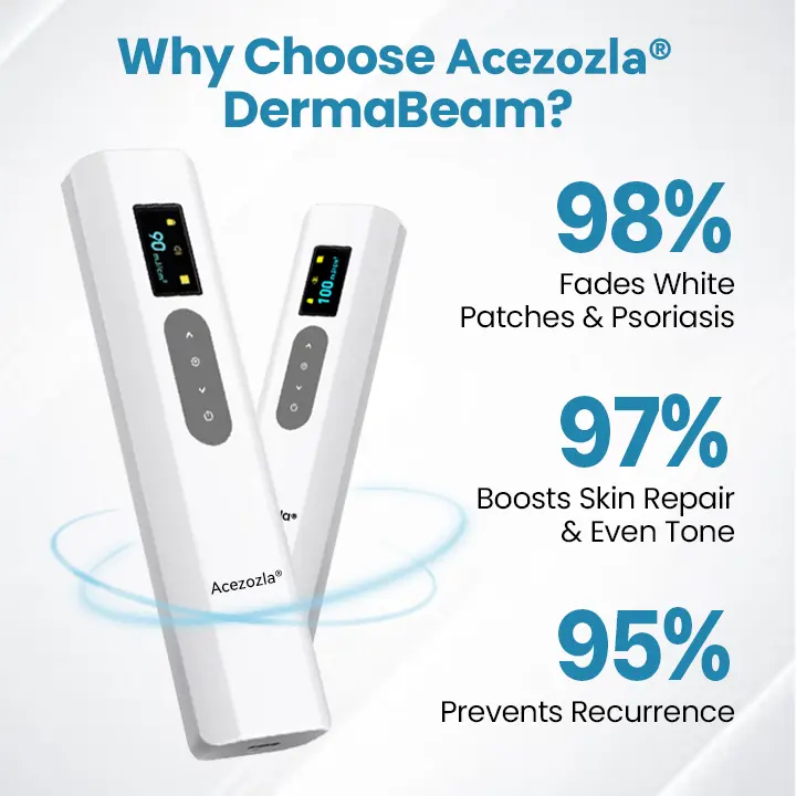 Dispositivo de terapia para vitíligo Acezozla® DermaBeam - Image 6