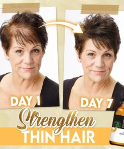 Suero para el crecimiento fuerte del cabello BaldFix (✨50 % de descuento)