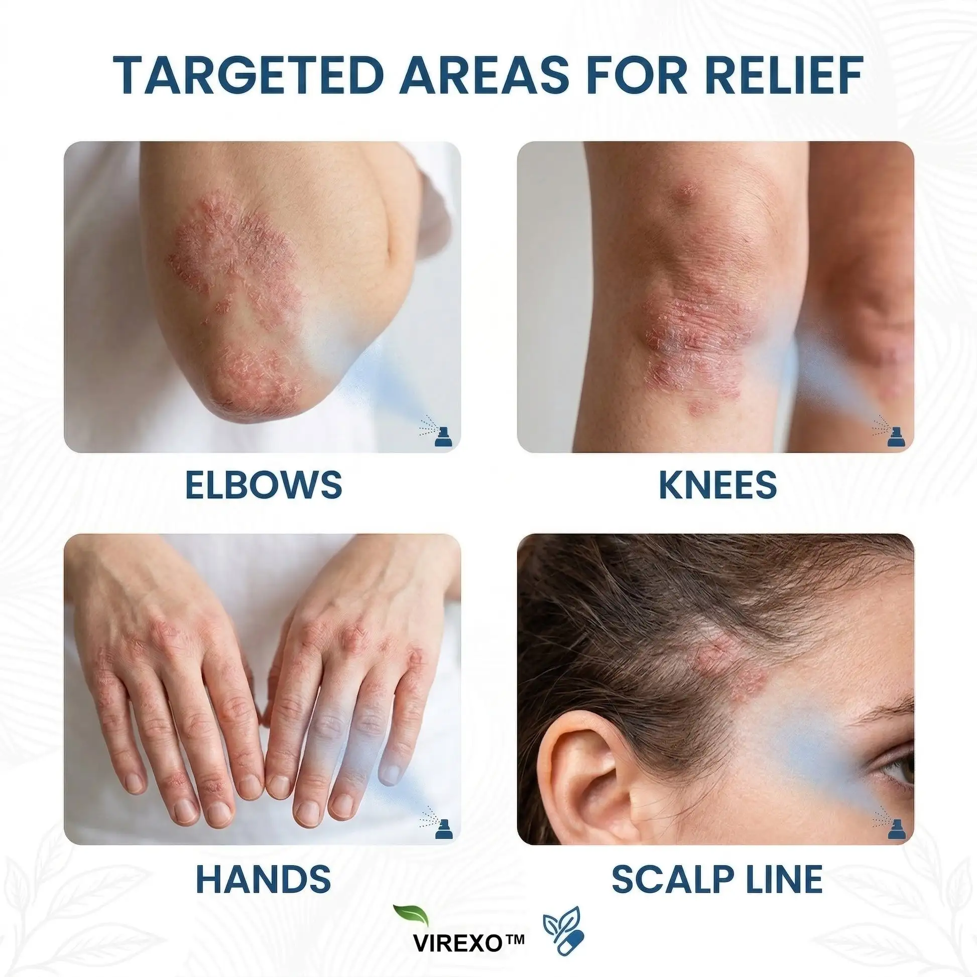 Virexo™ Spray botánico de magnesio - Image 2