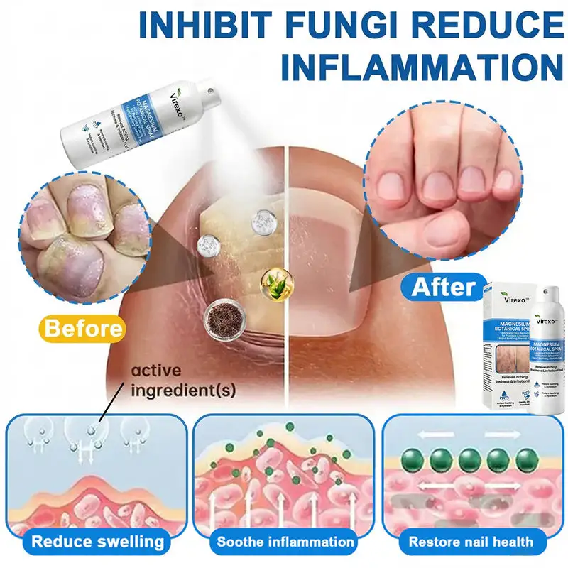 Virexo™ Spray botánico de magnesio - Image 4