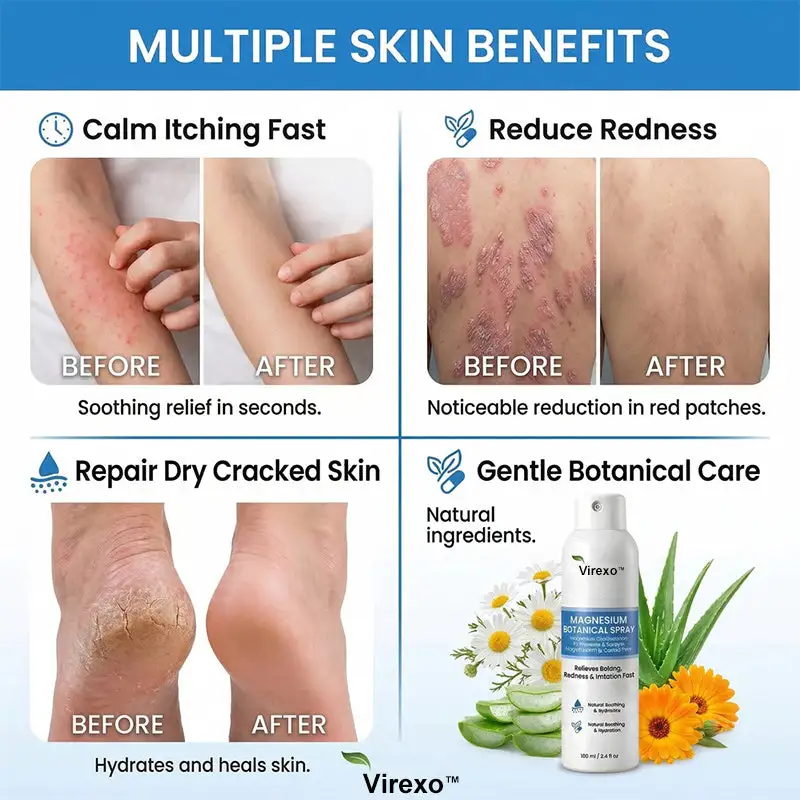 Virexo™ Spray botánico de magnesio - Image 9