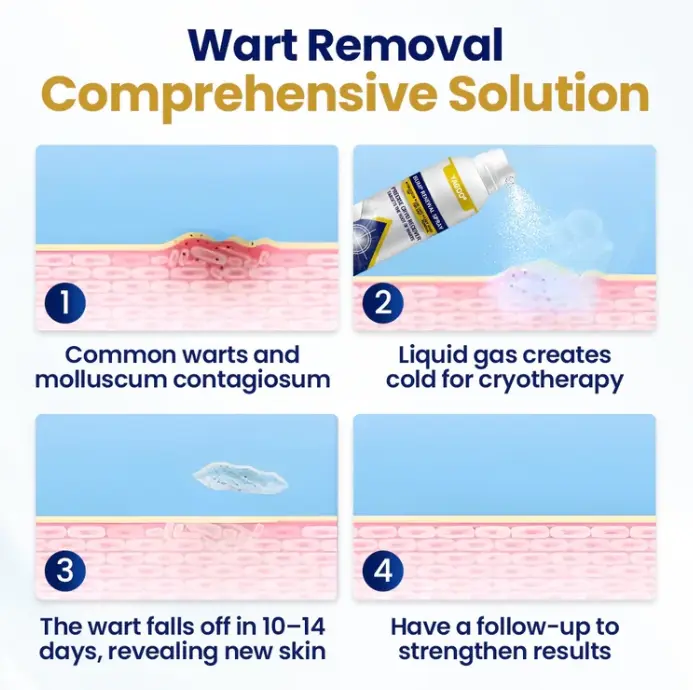 Spray renovador de protuberancias Chillique Yagoo® - Image 3