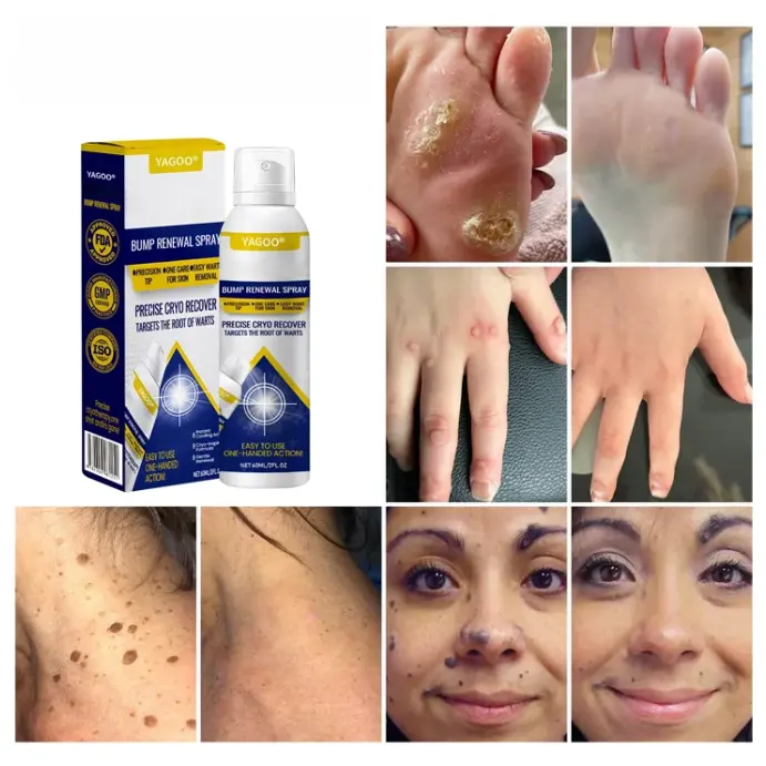 Spray renovador de protuberancias Chillique Yagoo® - Image 5